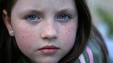 understanding lupus