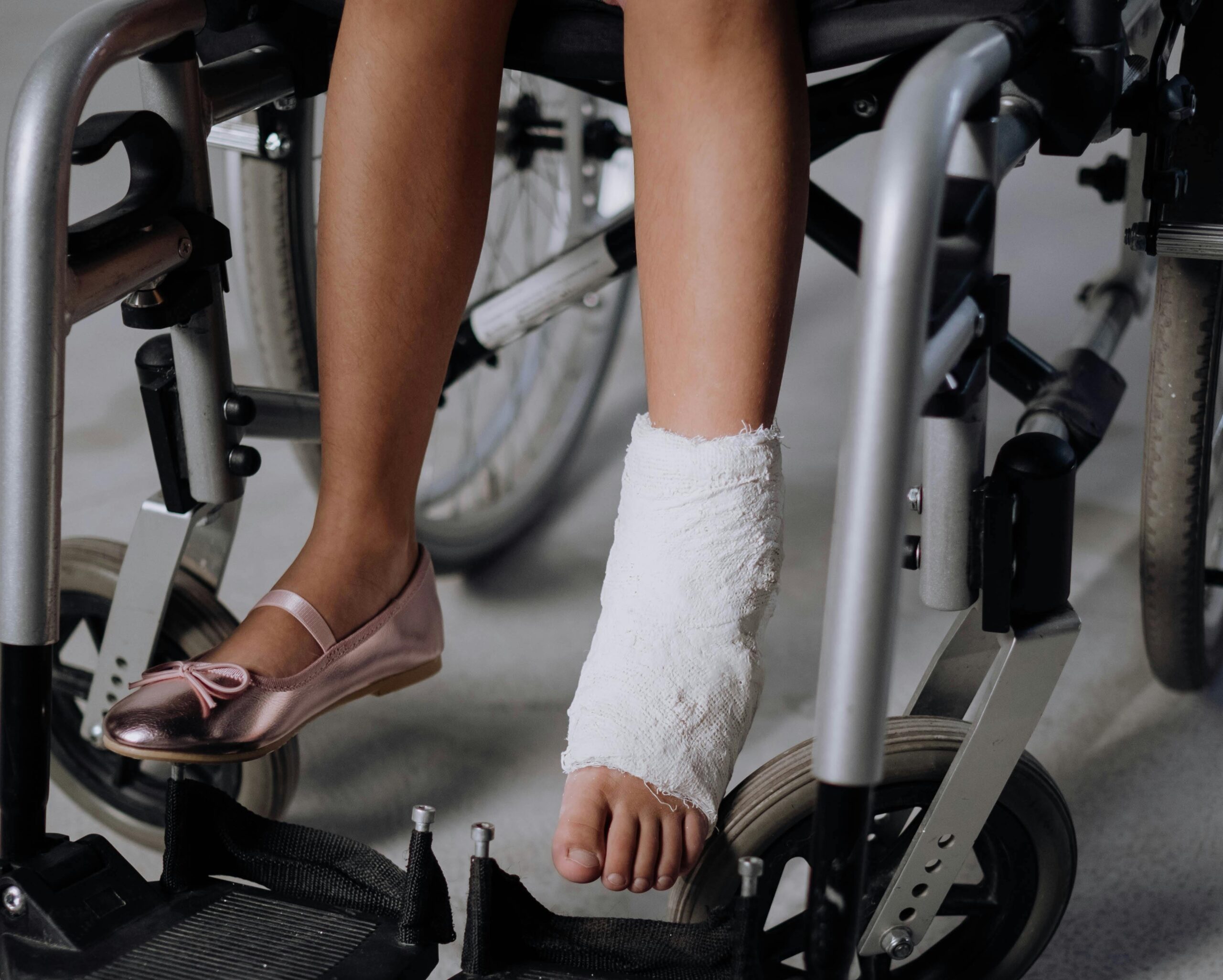 leg injury leg injury